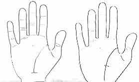 生命线横纹截断