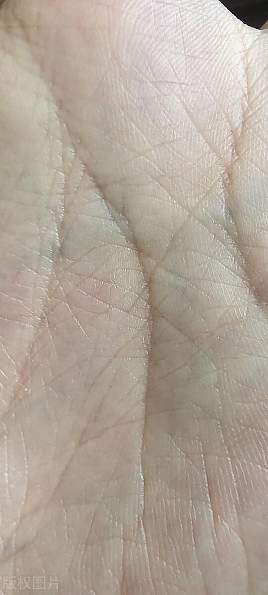 掌纹决定命运科学解析_手掌三条线连在一起_断掌命运学说