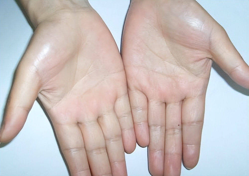 手相学三角纹解读_中国古代手相学文化_手掌三条线连在一起