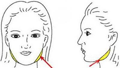 面部吸脂术后恢复日记_钻石吸脂术面部塑形效果_面部吸脂术会反弹吗