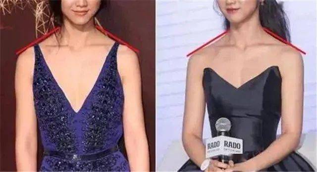 美人肩自测方法_美人肩标准_美人肩形态图解